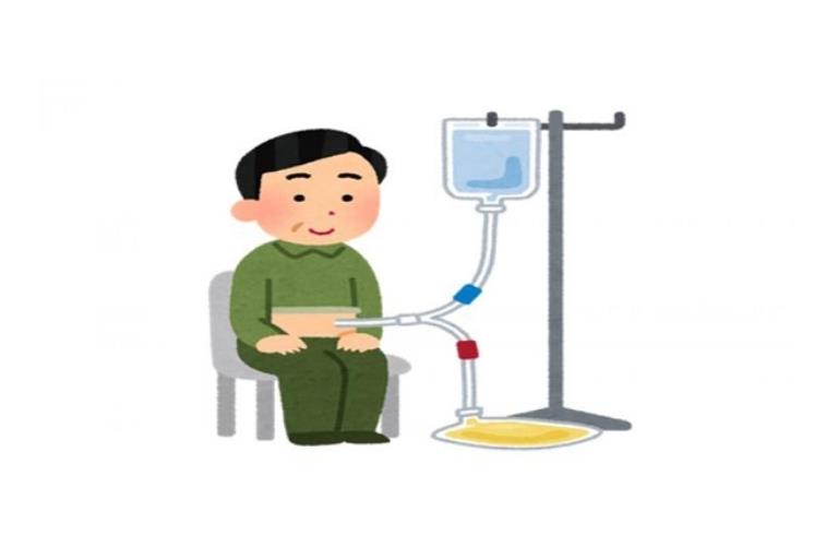 What is a dialysis , and which kind of disease raises the need for it?.